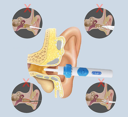 C-EARS device for removing earwax