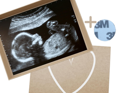 BUNNY BOO pamut zokni "Nagymama leszel" + doboz német nyelvű